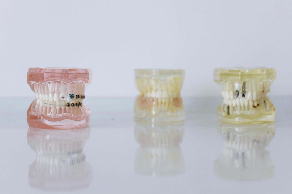 braces and retainers
